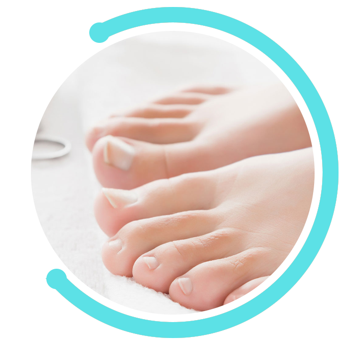 Podología Miraflores - Uñeros