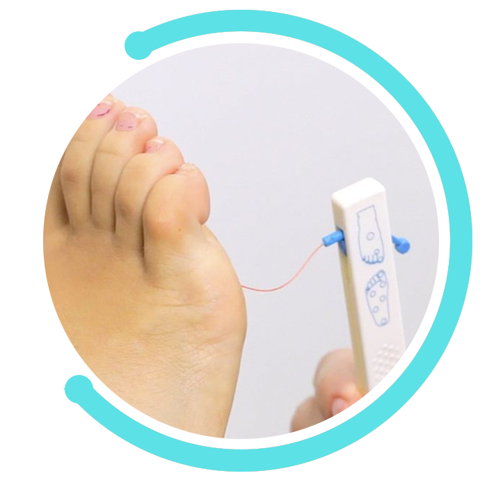 Podología Miraflores - Pie diabético